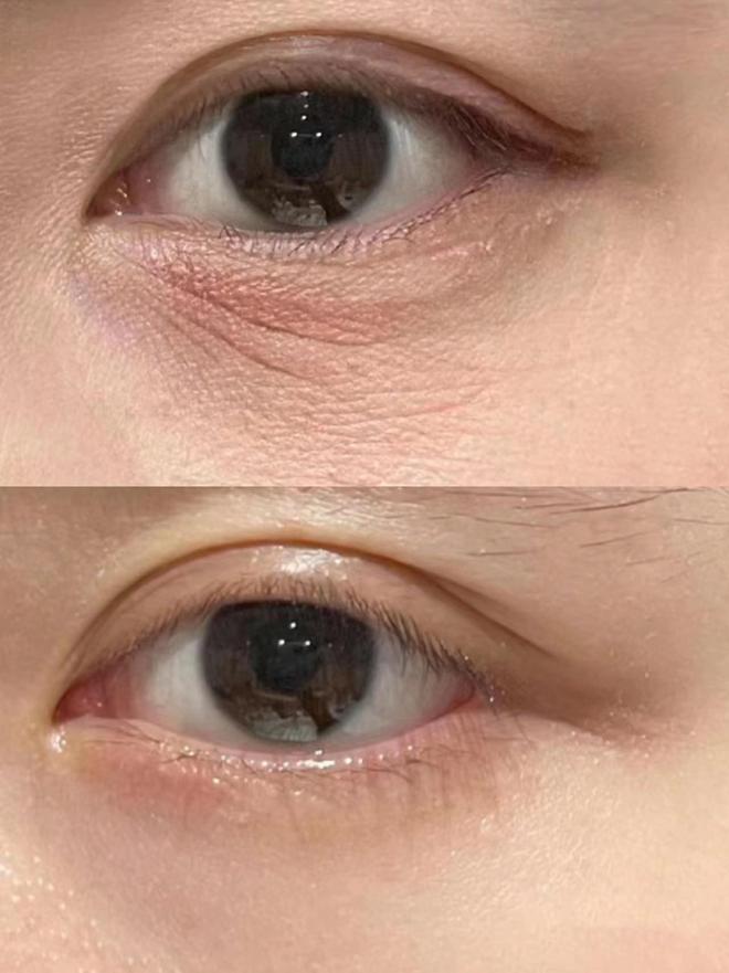 个牌子好？少走弯路的眼霜学生党亲测OG真人平台25岁男士眼霜去眼袋哪(图6)