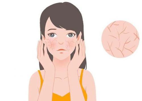 霜：修护敏感肌肤重塑健康屏障OG真人平台第二代薇诺娜特护(图4)